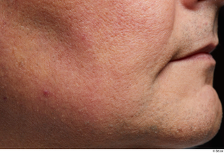 HD Face Skin Reuben Panjaitan cheek chin face skin pores…